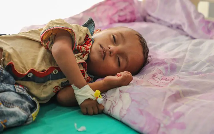 L’ONU lance un appel pour sauver 30 millions d’enfants victimes de malnutrition aigüe dans le monde